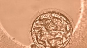 Процесс разморозки эмбрионов