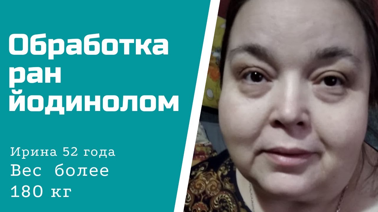 Вес 180 кг. Обработка раны йодинолом.mp4 смотреть онлайн