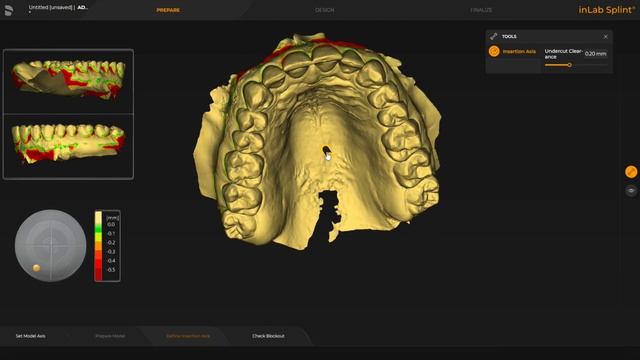 * IDDA MiniBytes - How to design a SPLINT with Inlab 22 with STL's from ANY scanner * смотреть онлайн