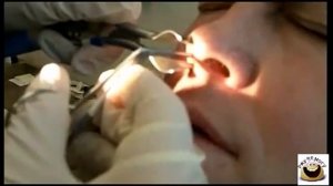 Самая большая в мире КОЗЯВКА