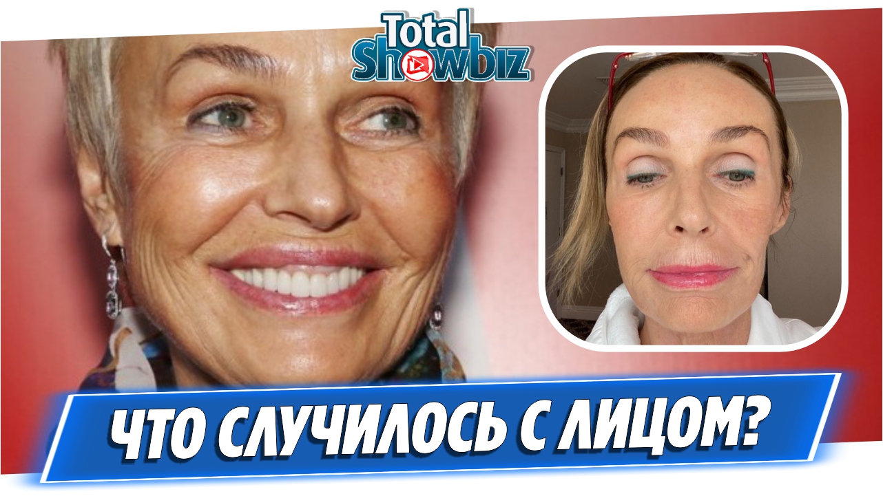 Что случилось с лицом Натальи Андрейченко?