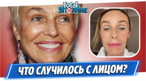 Что случилось с лицом Натальи Андрейченко?