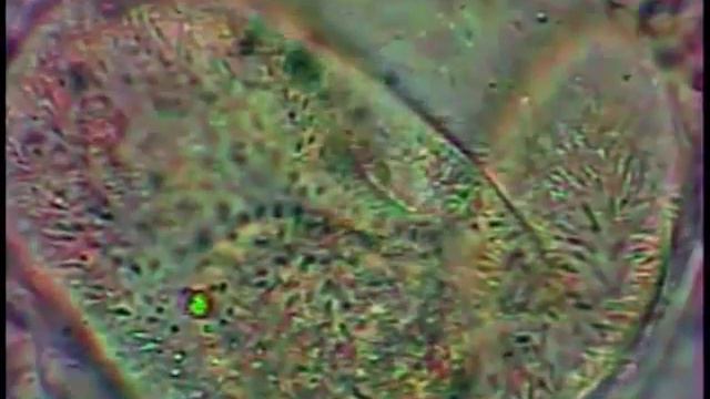 TT34 - Aмеба | Amoeba biology | смотреть онлайн