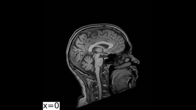 После физики - Мозг мой — Враг мой [S01E06] смотреть онлайн