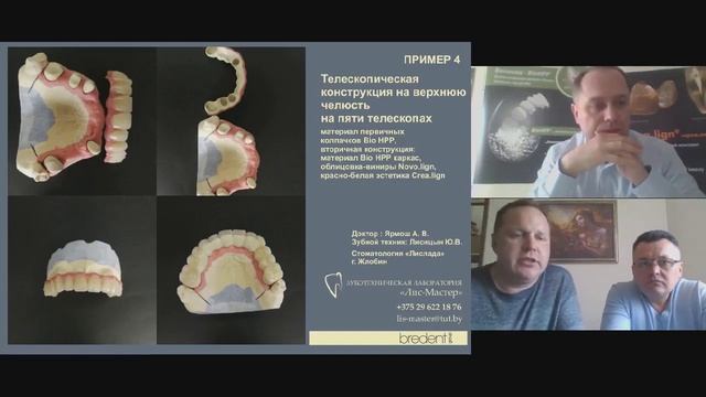 Вебинар №6. Возможности использования биосовместимых безметаловых материалов. Организатор - bredent смотреть онлайн