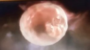 Как происходит имплантация эмбриона