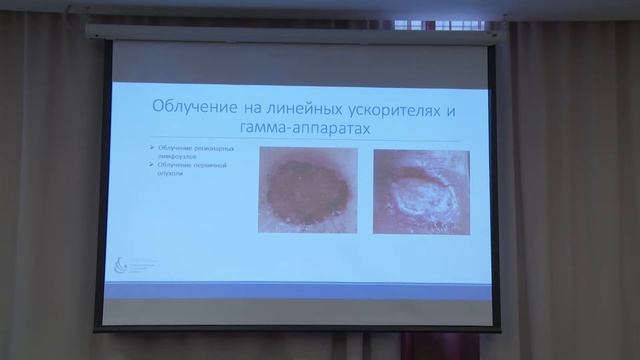 Николаева Е.Н. — Возможности дистанционной лучевой терапии в лечении опухолей кожи