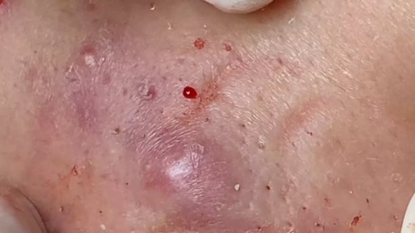 Relax Every Day With Sac Dep Spa #0050