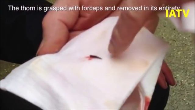 Сквозное проникновение шипа в копыто лошади, удаление шипа и перевязка смотреть онлайн