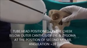 Прицельная R   графия позиционирование пленки при съемке различных групп зубов Стоматология