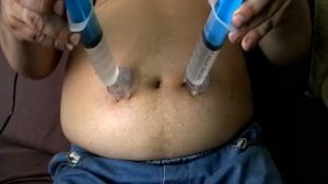 десять уколов в живот