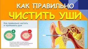 КАК ПРАВИЛЬНО ЧИСТИТЬ УШИ. ПОЧЕМУ НЕЛЬЗЯ ВАТНЫМИ ПАЛОЧКАМИ