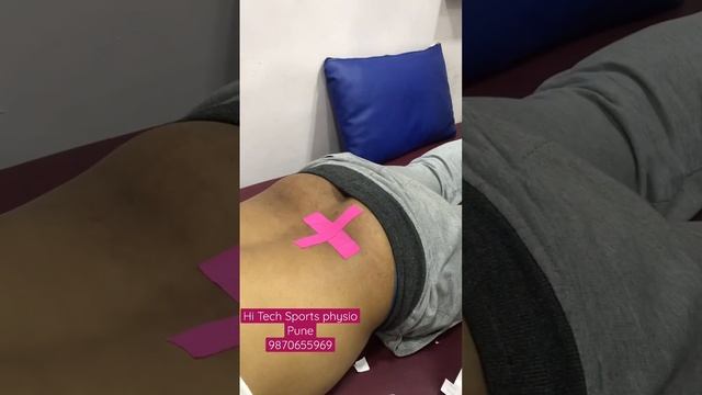 Kinesio Taping | lower back pain|Dr.Mohammed Zaid Tai смотреть онлайн