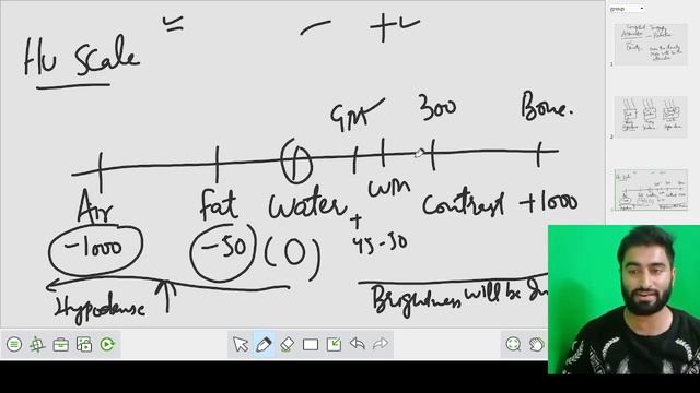 Computed Tomography || Hounsfield Scale || Window Level || Window Width смотреть онлайн