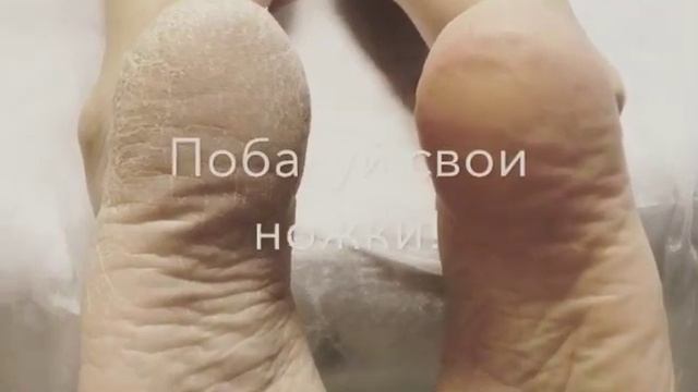 смарт педикюр рекламка смотреть онлайн