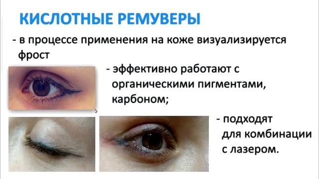 Какие бывают ремуверы