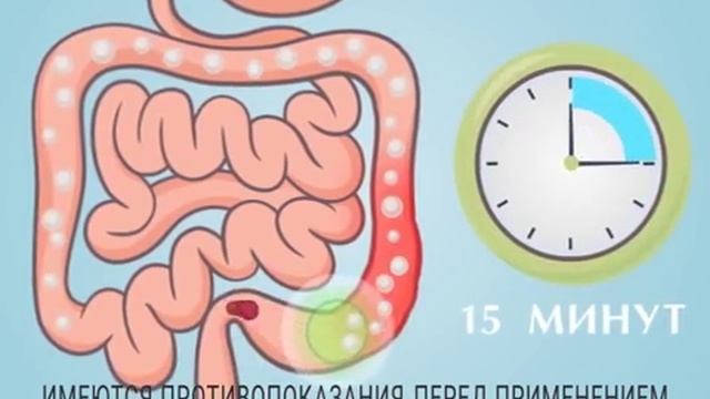 РектАктив сильнее запора! смотреть онлайн