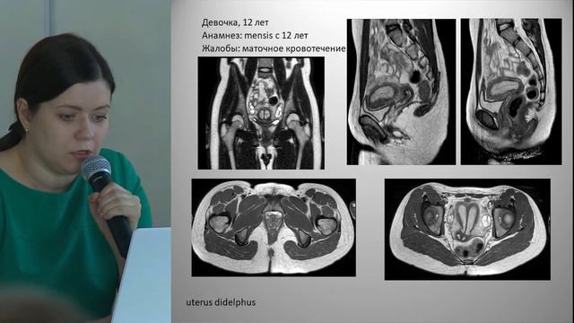Возможноти МРТ в диагностике аномалий женской репродуктивной системы смотреть онлайн