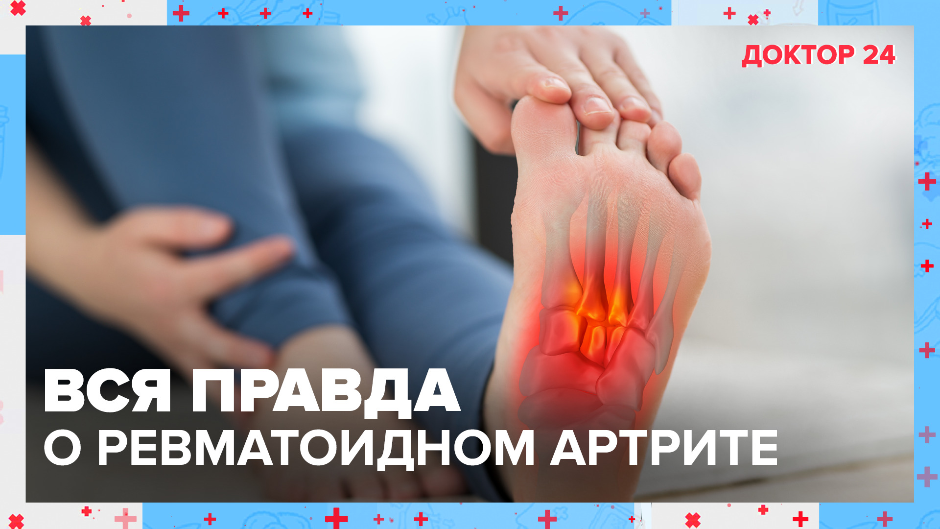 Как предотвратить РЕВМАТОИДНЫЙ АРТРИТ? | Доктор 24