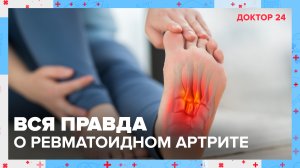 Как предотвратить РЕВМАТОИДНЫЙ АРТРИТ? | Доктор 24