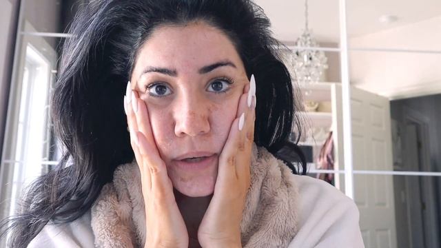 CHEMICAL PEEL | PERFECT DERMA PEEL - DAY BY DAY POST PROCEDURE | BY SARV