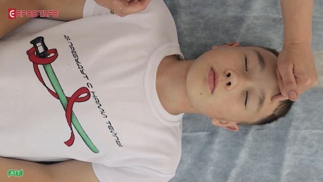 Нарушение чувствительности лица. Лечение тройничного нерва. Тейпирование в логопедии..mp4 смотреть онлайн