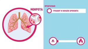 Как распознать влажный кашель (Супер Дети)