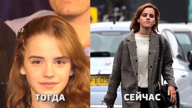 Как менялась ЭММА УОТСОН (Emma Watson)|Тогда и сейчас