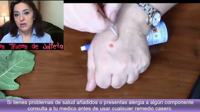 TRES REMEDIOS PARA ELIMINAR VERRUGAS. Three remedies to eliminate warts. смотреть онлайн
