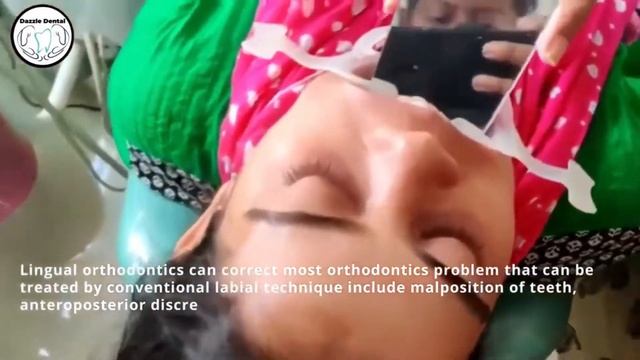 Lingual Orthodontics Treatment | Dazzle Dental Care Bhubaneswar смотреть онлайн