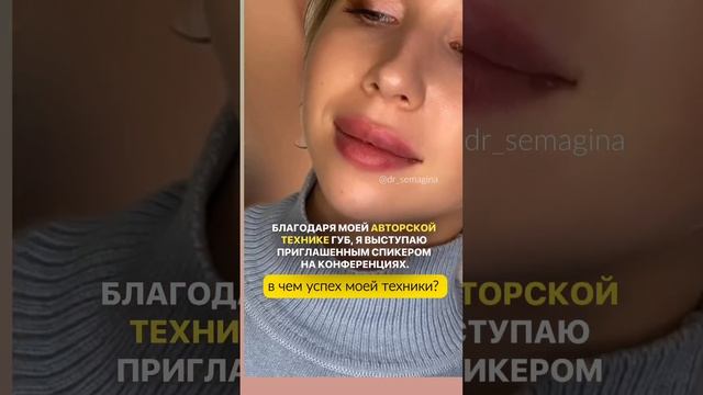 Форм губ и запросов на коррекцию бесчисленное множество #victoriasemagina #инъекции #увеличениегуб смотреть онлайн