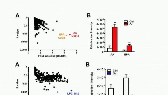 Dr. Krzeszinski On “Lipid Osteoclastokines Regulate Breast Cancer Bone Metastasis” смотреть онлайн