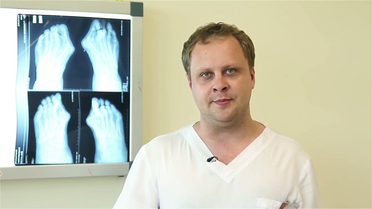 Худяков Никита Алексеевич - врач травматолог-ортопед Клинического госпиталя ИДК смотреть онлайн