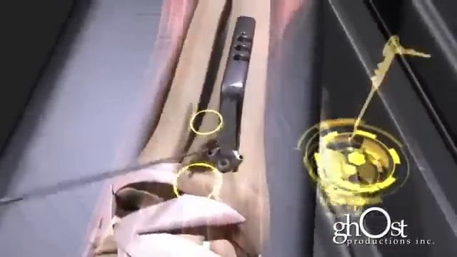 Как чинят переломы. смотреть онлайн