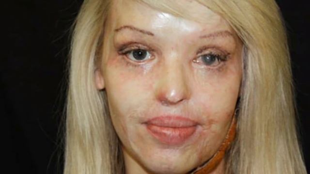 Katie Piper Presentation смотреть онлайн