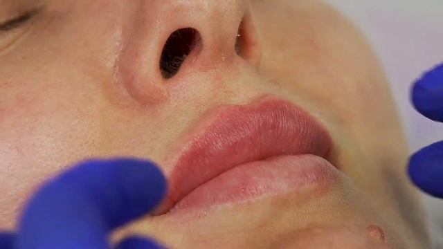 Мастер-класс от Ирины Литус. Аугментация губ филлерами Perfectha смотреть онлайн