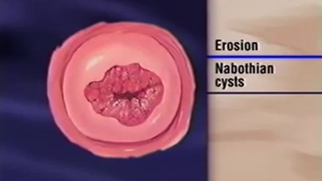 Female Genitalia Examination.wmv смотреть онлайн