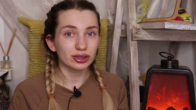 БРЕКЕТЫ: ВЫБОР И СМЕНА ОРТОДОНТА / прикус, кривые зубы, виниры, врачебная этика. Что дальше? смотреть онлайн