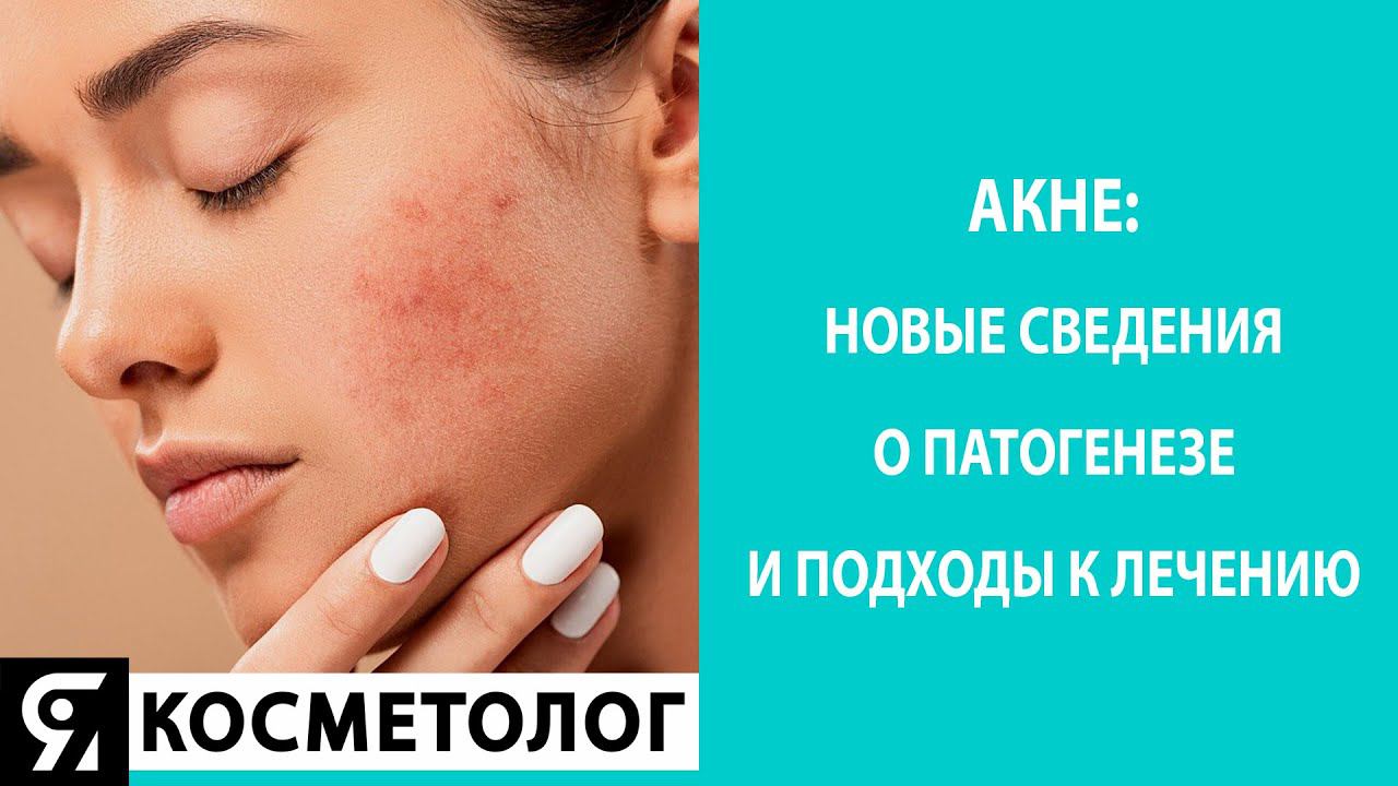 Акне. Новые сведения о патогенезе и подходы к лечению смотреть онлайн