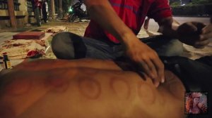 Вьетнамский массаж // 2