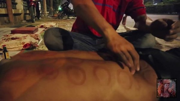 Вьетнамский массаж // 2