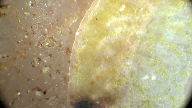 Helobdella Stagnalis