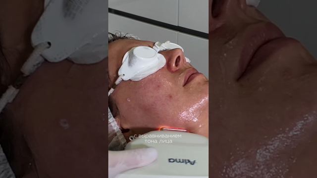 Процедура Glow Flow - комплексное омоложение за 1 сессию | сеть клиник косметологии GEN87 смотреть онлайн