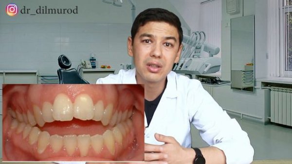 EGRI TISHLARNI DAVOLASH / ЭГРИ ТИШЛАРНИ ДАВОЛАШ