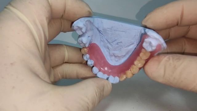 Частично съёмный зубной протез смотреть онлайн