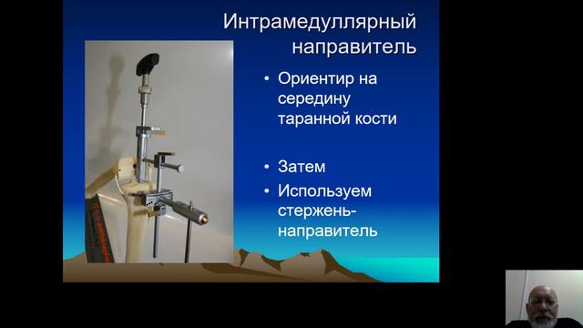 Эндопротезирвоание коленного сустава 2 Ежов смотреть онлайн
