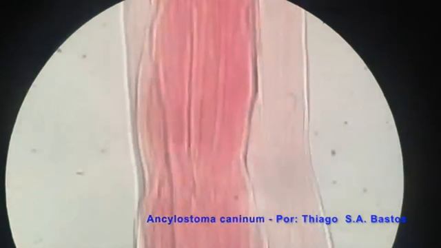 Ancylostoma caninum ♂ Vista dorsal1 смотреть онлайн