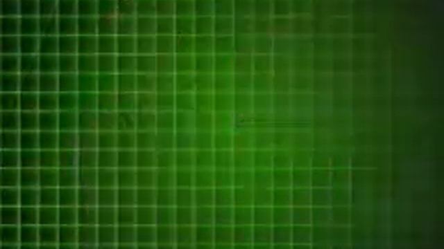 Первая медицинская помощь при несчастных случаях на производстве смотреть онлайн