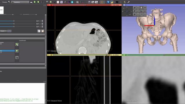 Transform Module and 3D view reset - 3D Slicer смотреть онлайн