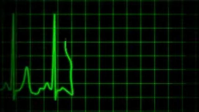 Наша жизнь проходит вот так смотреть онлайн